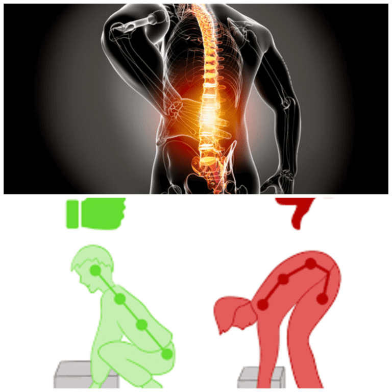 Starke Rückenschmerzen Was tun? Ursachen, schnelle Hilfe und wirksame Tipps starke rückenschmerzen was tun